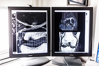 Bildschirme zur Auswertung des Magnetresonanztomographen
